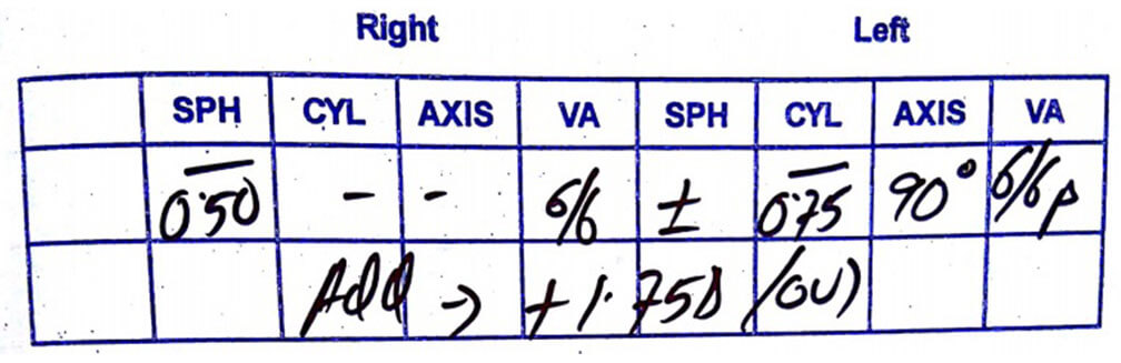 Single Vision - Astigmatism